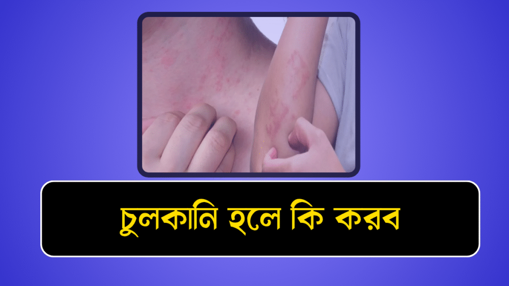 চুলকানি হলে কি করব